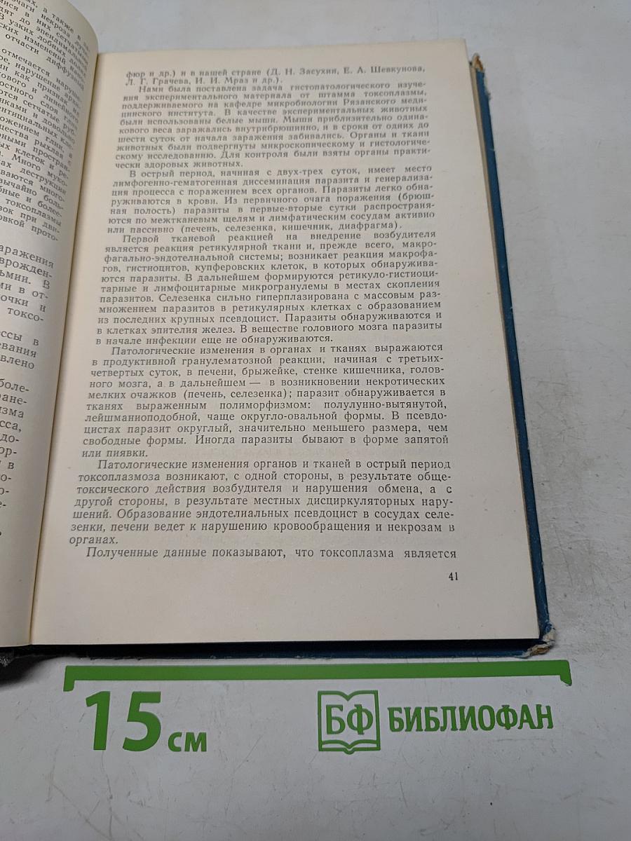 Токсоплазмоз