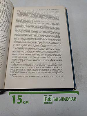 Токсоплазмоз