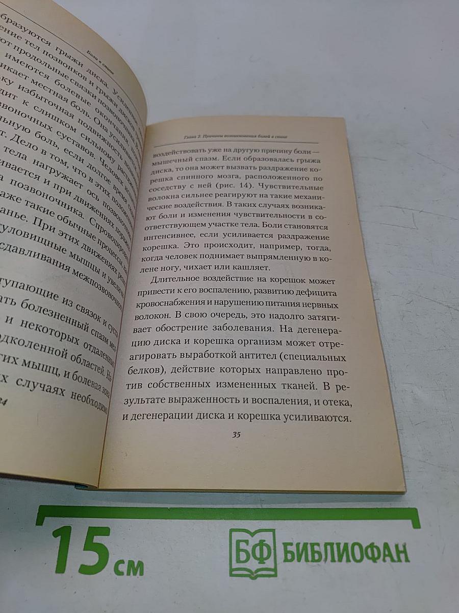 Боли в спине