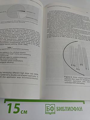 Brachytherapy from Radium to Optimization