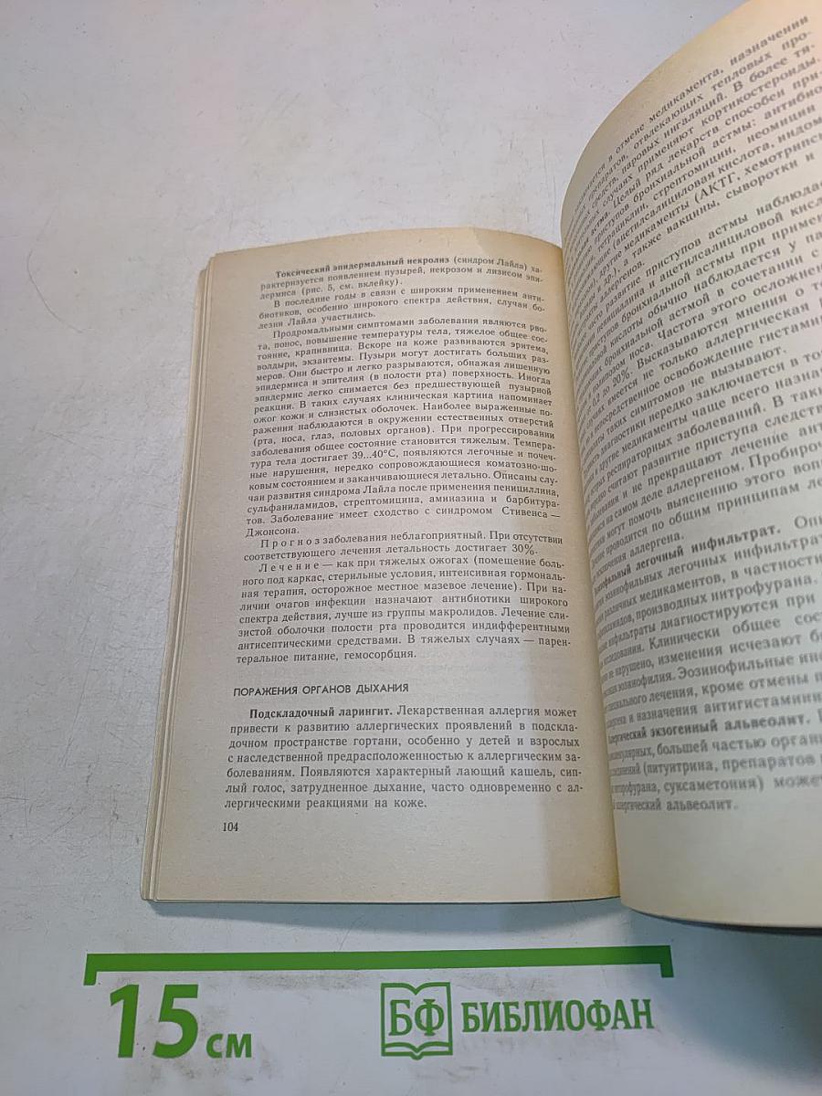 Аллергические заболевания