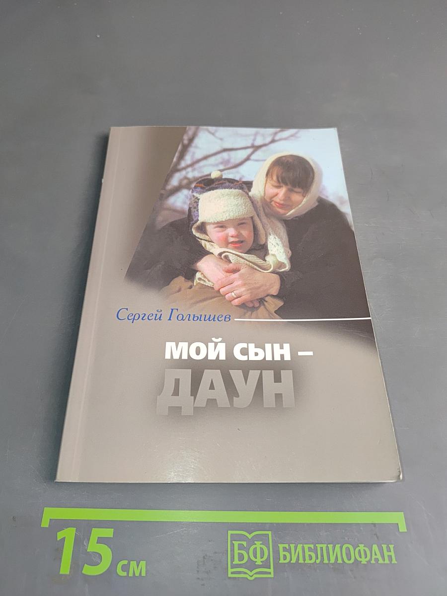 Мой сын – Даун