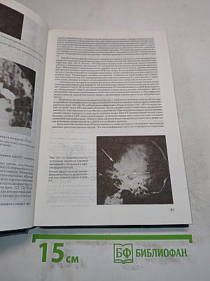 Внутренние болезни. Книга 9