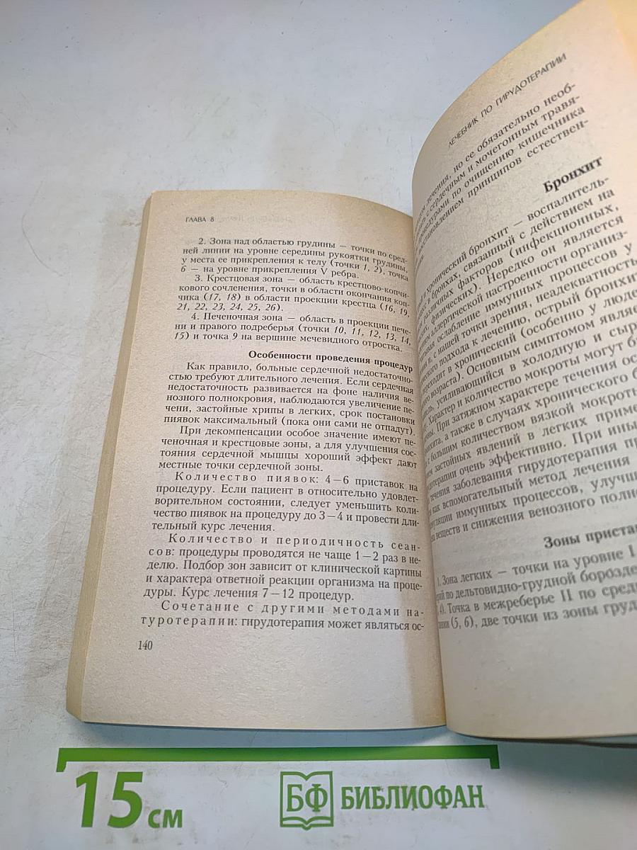 Вам поможет пиявка