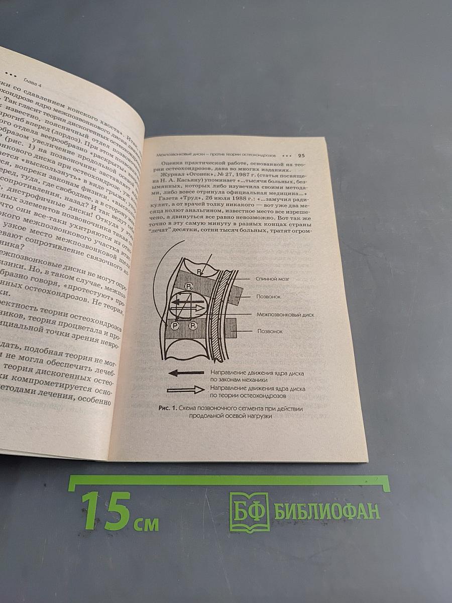 Остеохондрозы. Практика исцеления