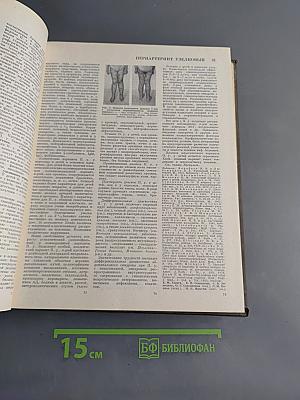 Большая медицинская энциклопедия. Том 19. Перельман – Пневмопатии