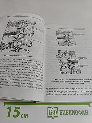 Массаж при болях в спине и сколиозах (+CD с видеокурсом)