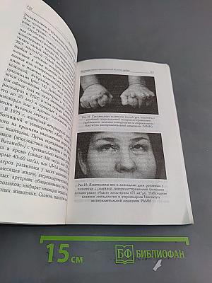 Быть или не быть инфаркту