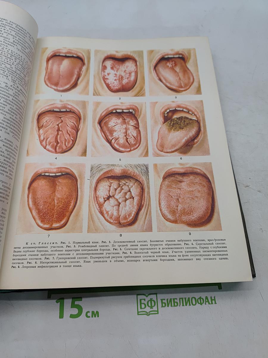 Большая медицинская энциклопедия. Том 6. Гипотиреоз – Дегенерация