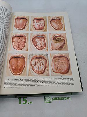 Большая медицинская энциклопедия. Том 6. Гипотиреоз – Дегенерация