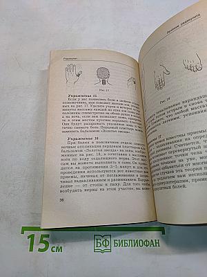 Радикулит