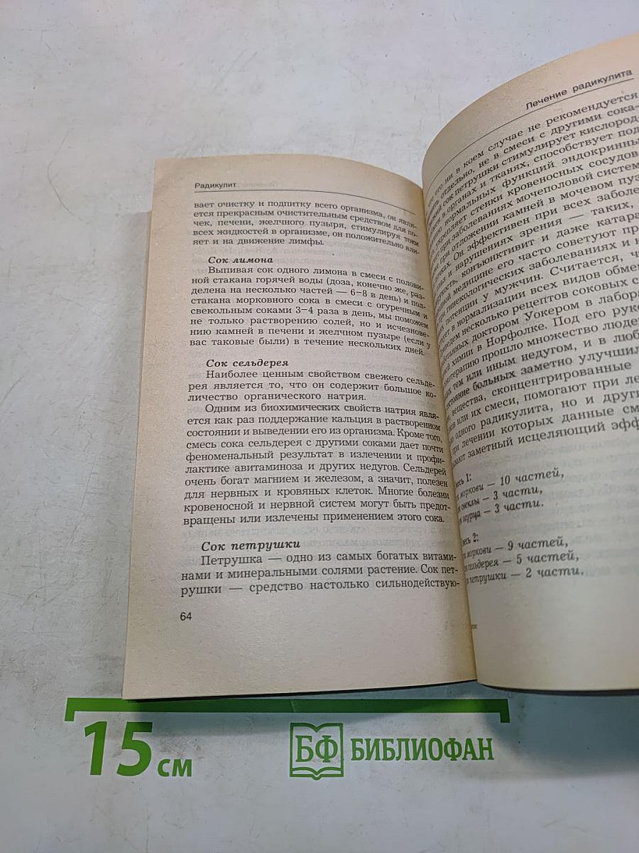 Радикулит