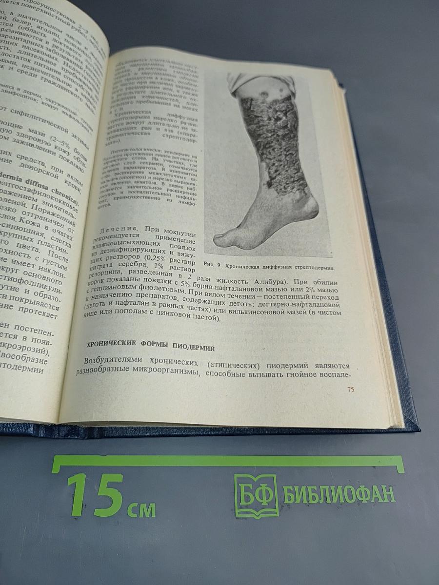 Кожные и венерические болезни