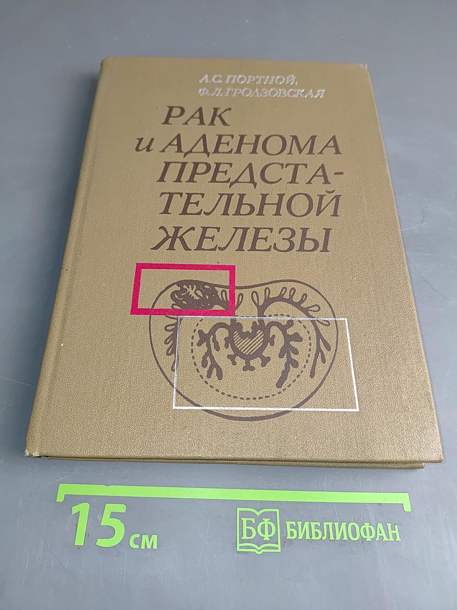 Рак и аденома предстательной железы