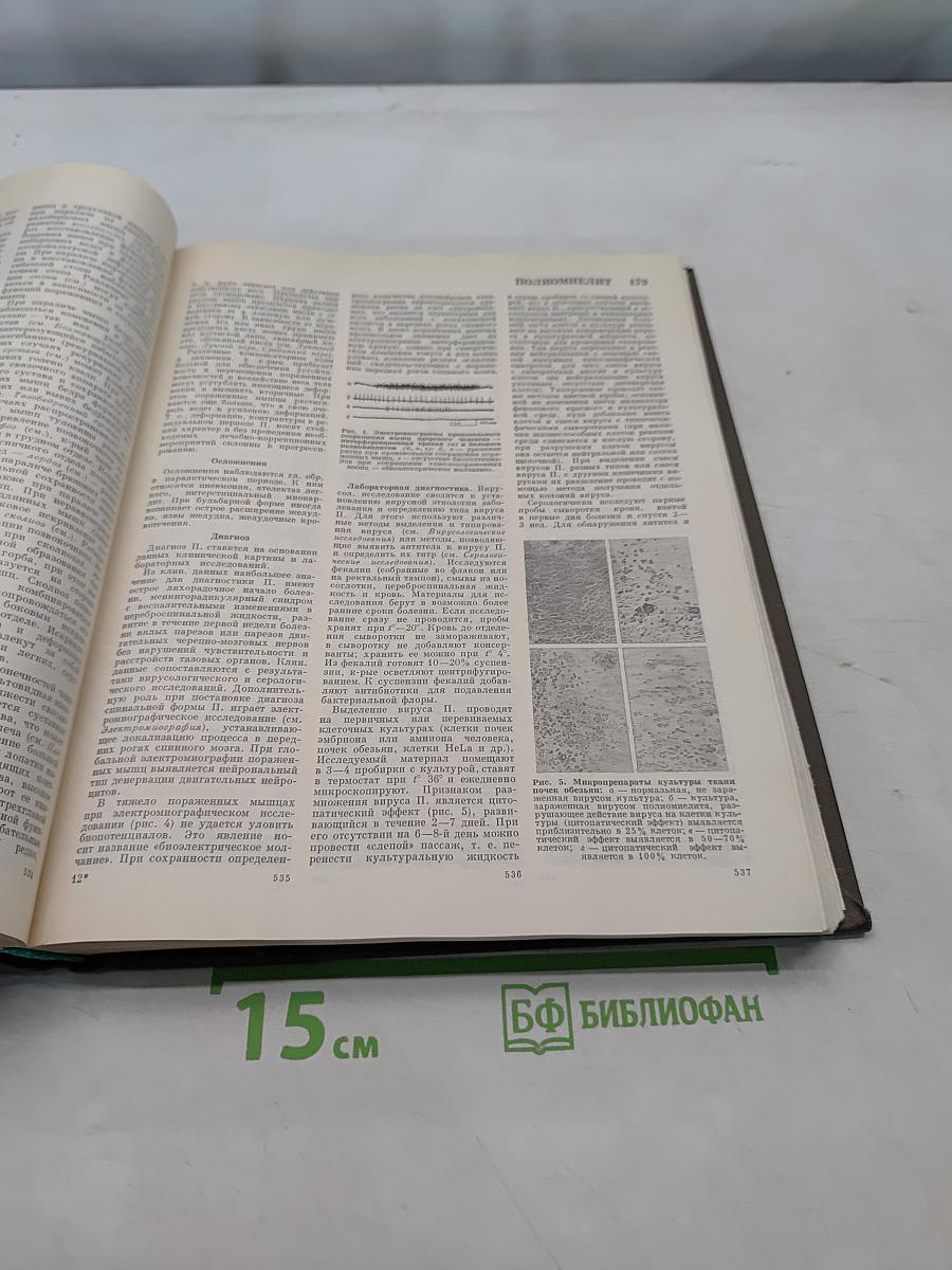 Большая медицинская энциклопедия. Том 20. Пневмопексия — Преднизолон