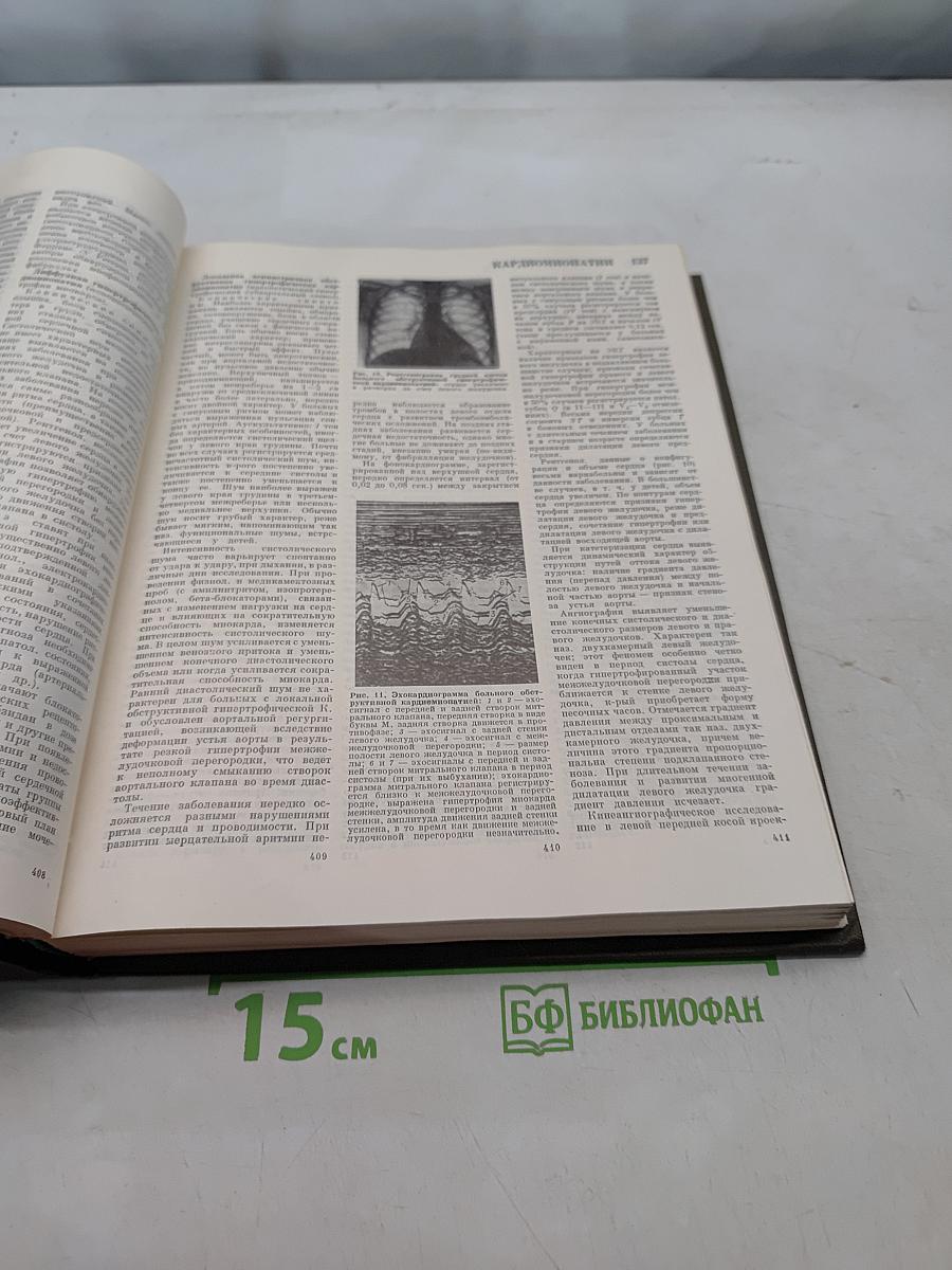 Большая медицинская энциклопедия. Том 10. Кабаков – Коллекция