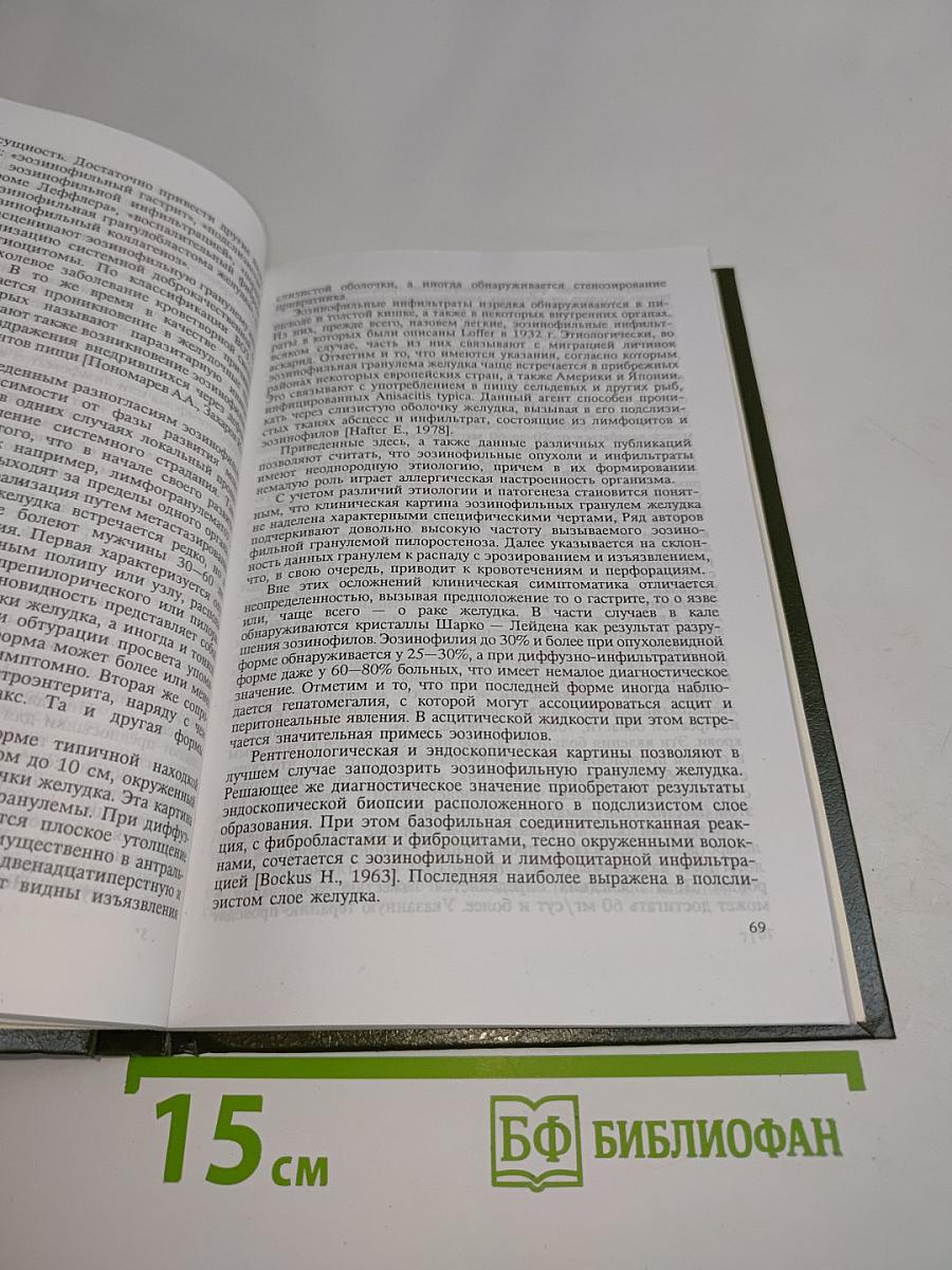 Болезни органов пищеварения