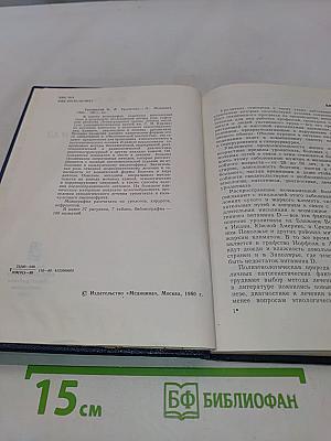 Уролитиаз