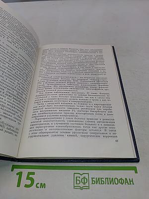 Уролитиаз