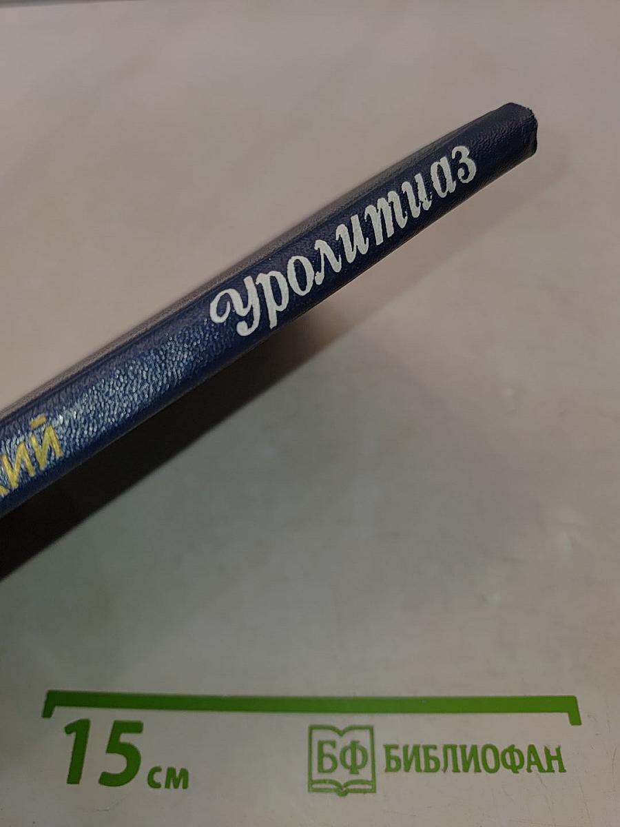 Уролитиаз