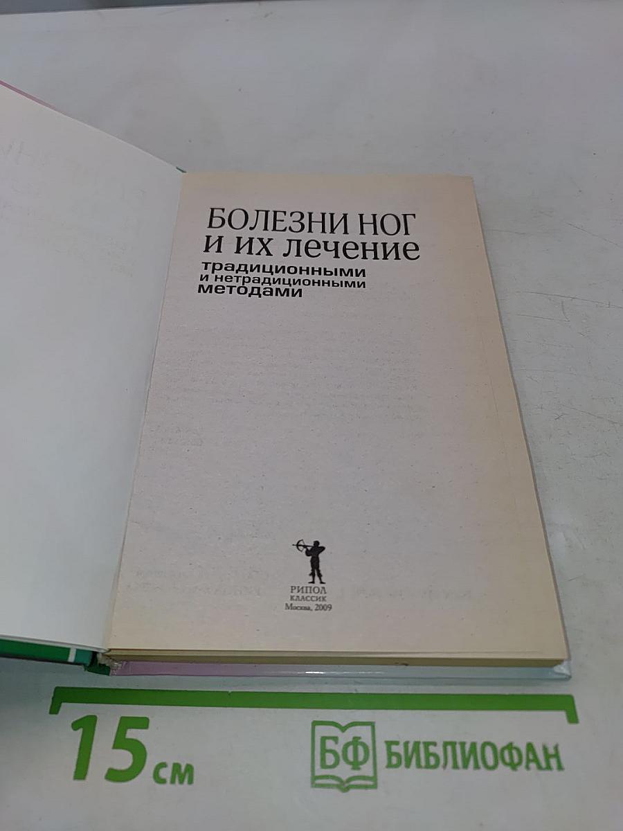 Болезни ног и их лечение: традиционными и нетрадиционными методами