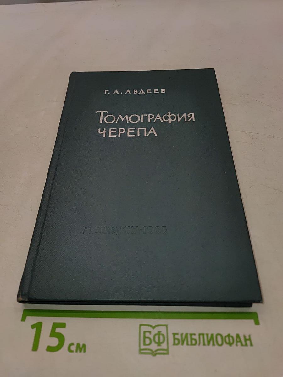 Томография черепа