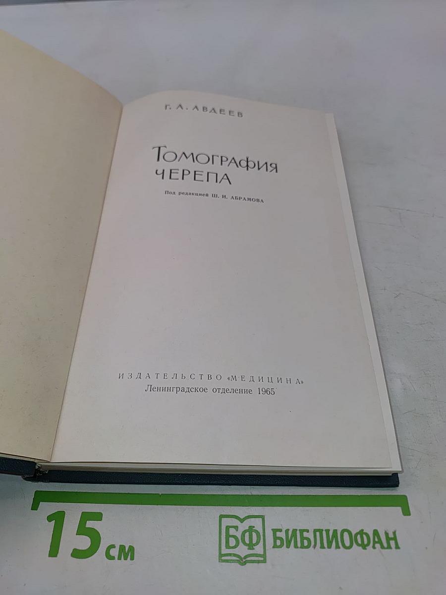 Томография черепа