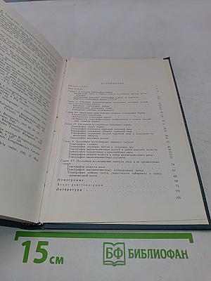 Томография черепа