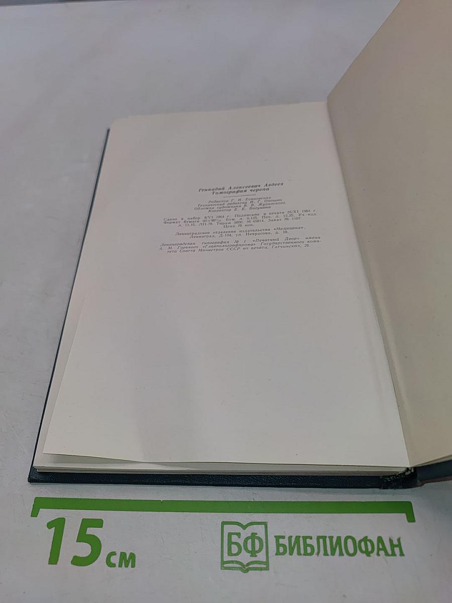Томография черепа