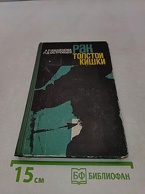 Рак толстой кишки