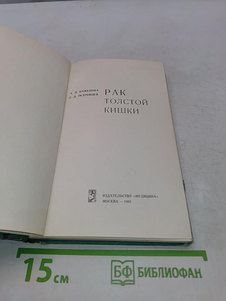 Рак толстой кишки