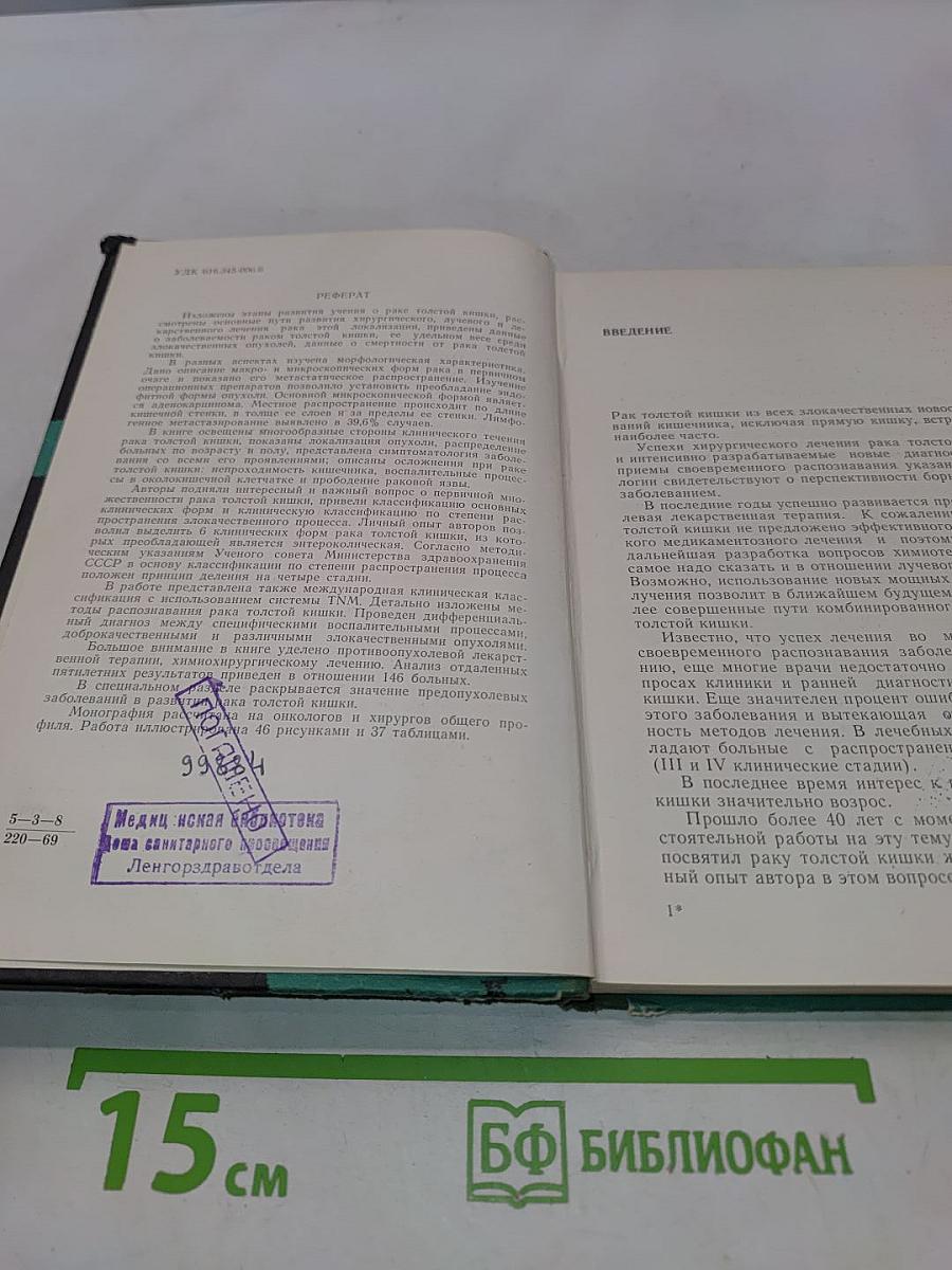 Рак толстой кишки
