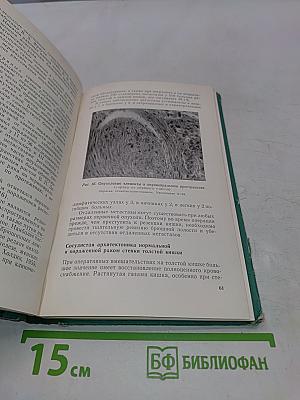 Рак толстой кишки