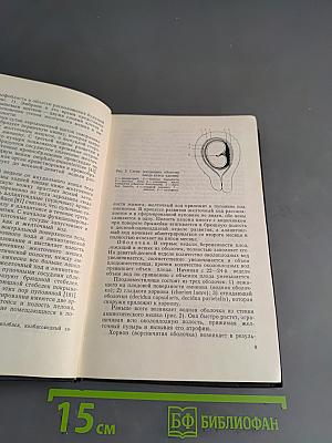Патология последа человека и ее влияние на плод