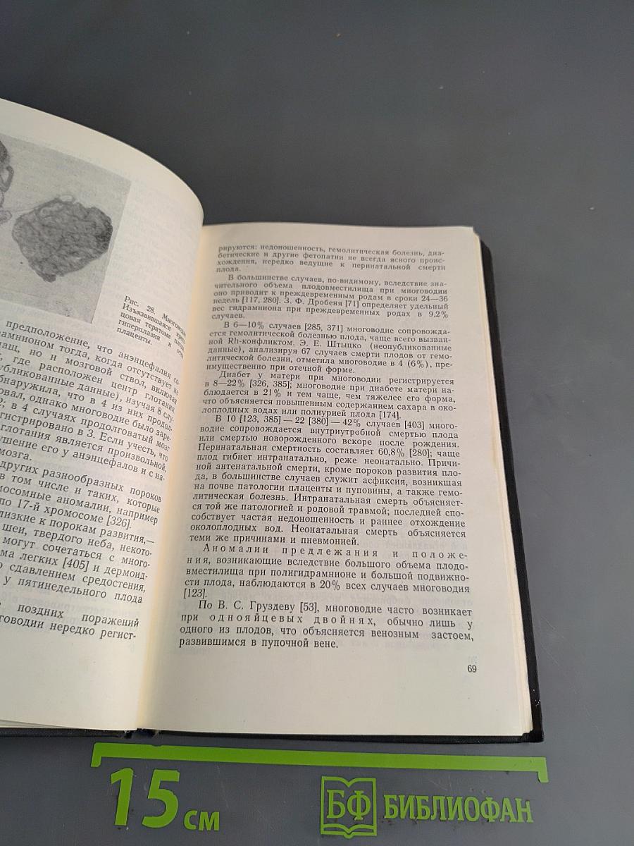 Патология последа человека и ее влияние на плод