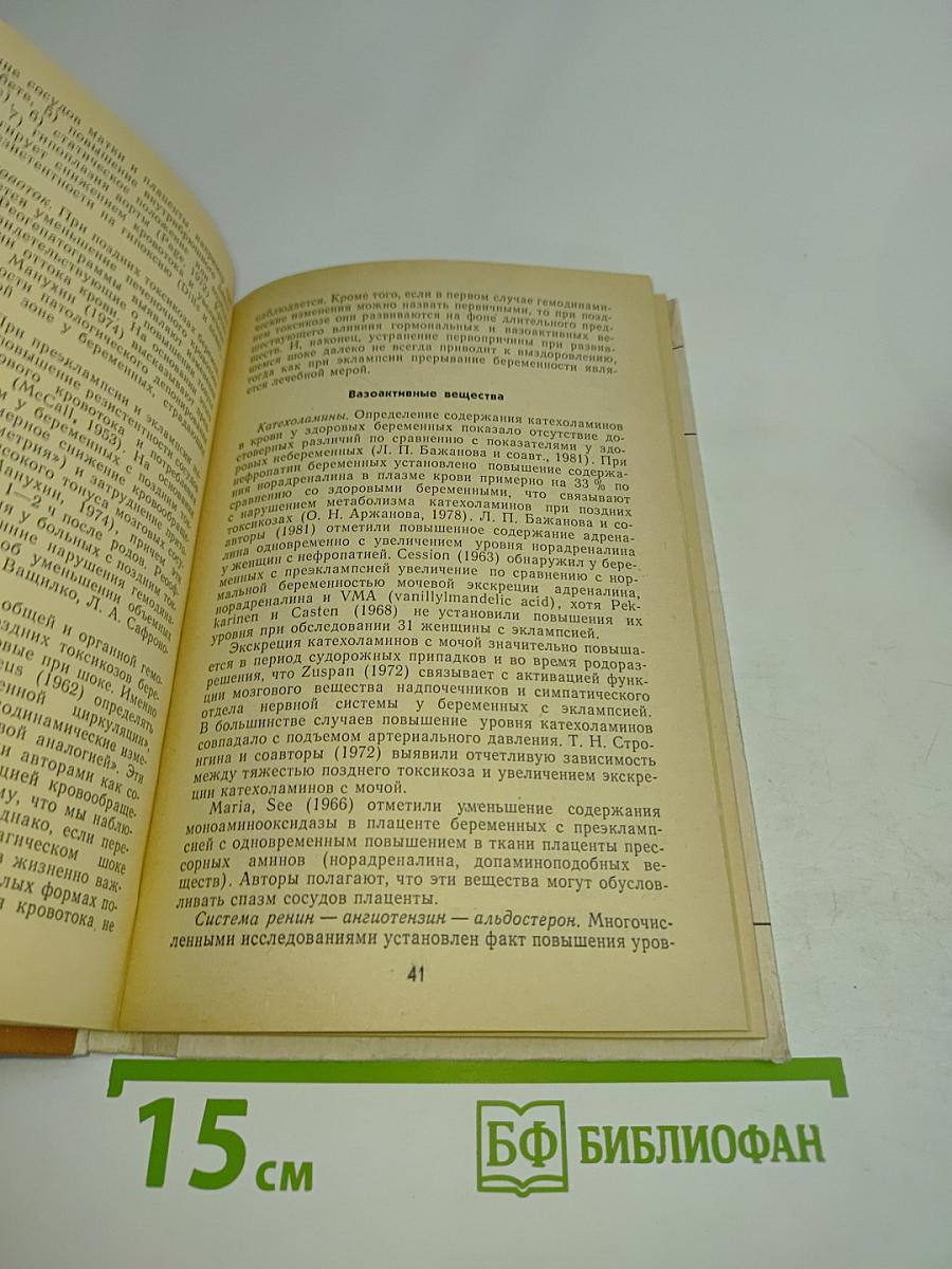 Эклампсия