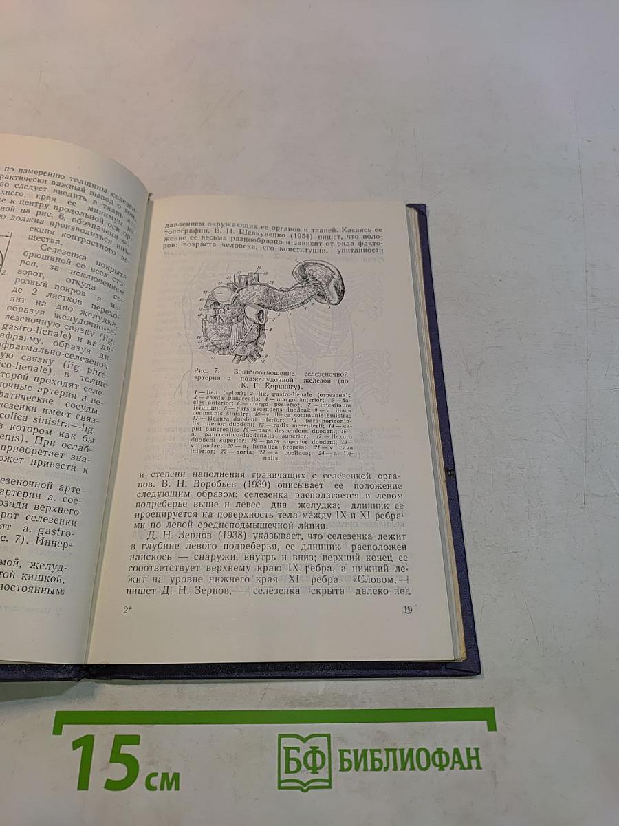Спленопортография