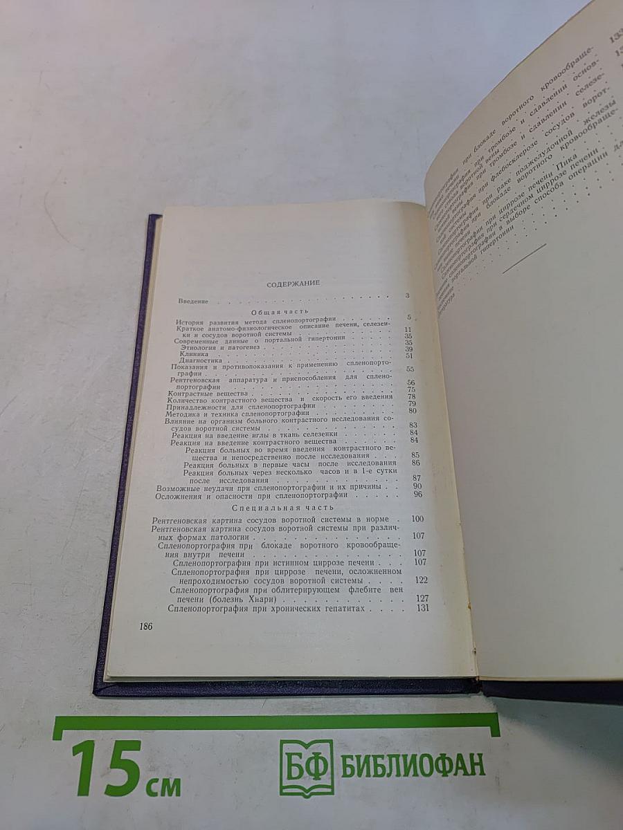 Спленопортография