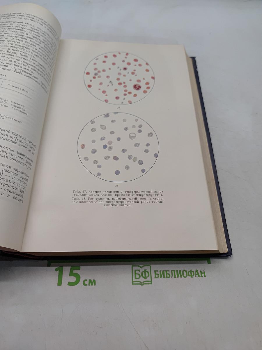 Клиническая гематология