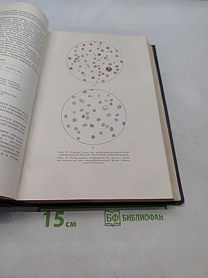 Клиническая гематология
