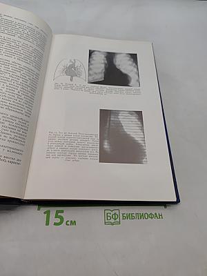 Рентгенологическое исследование при врожденных пороках сердца