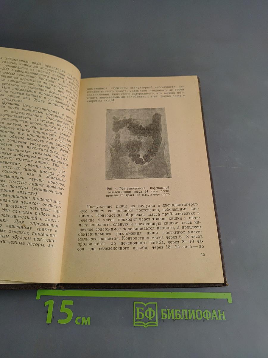 Запоры и их лечение