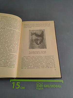 Запоры и их лечение