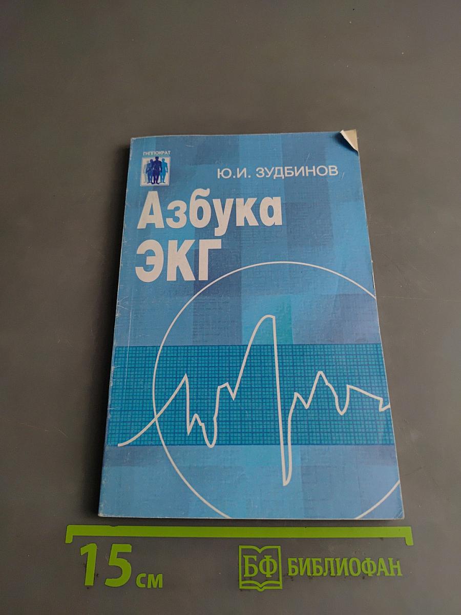 Азбука ЭКГ