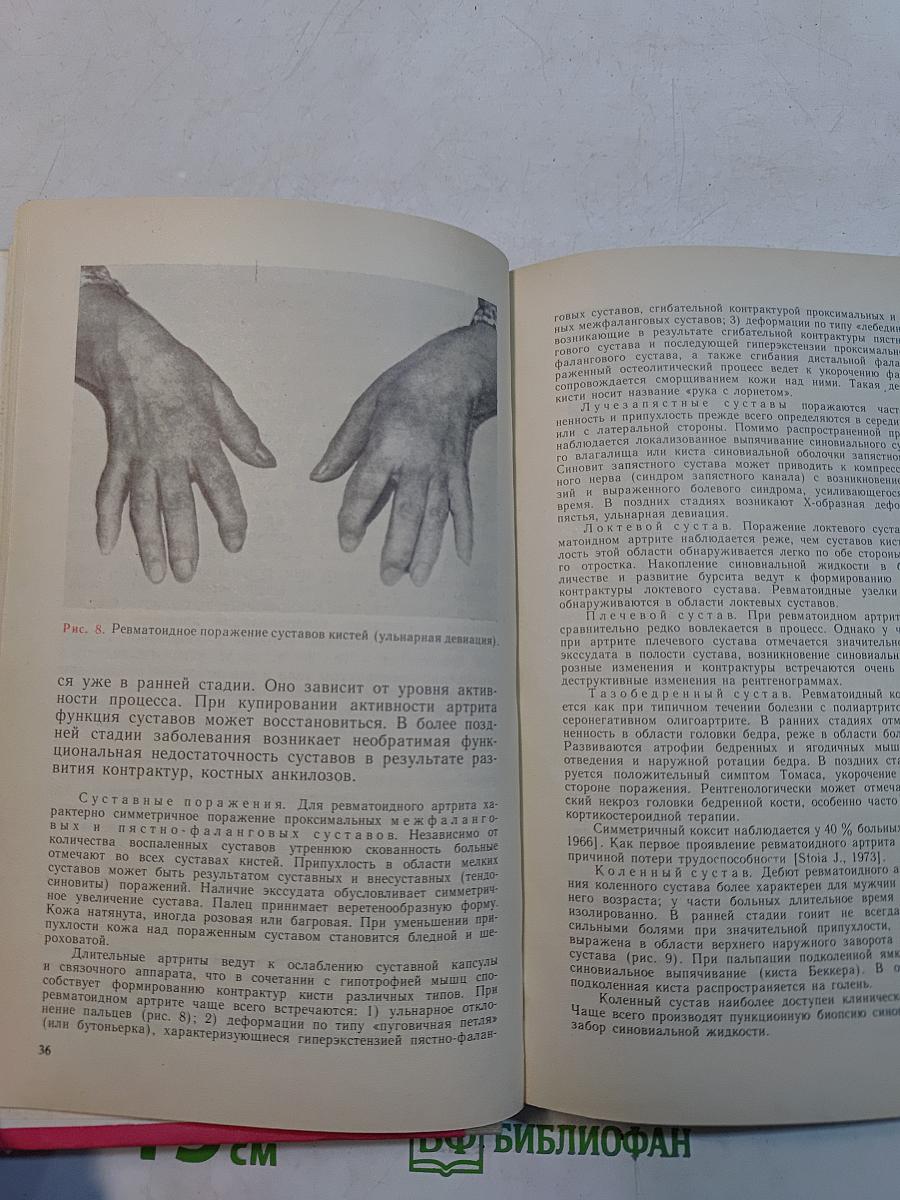 Диагностика и лечение болезней суставов