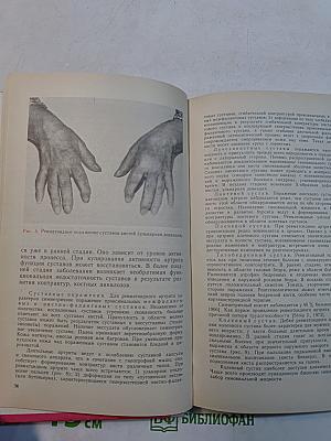 Диагностика и лечение болезней суставов