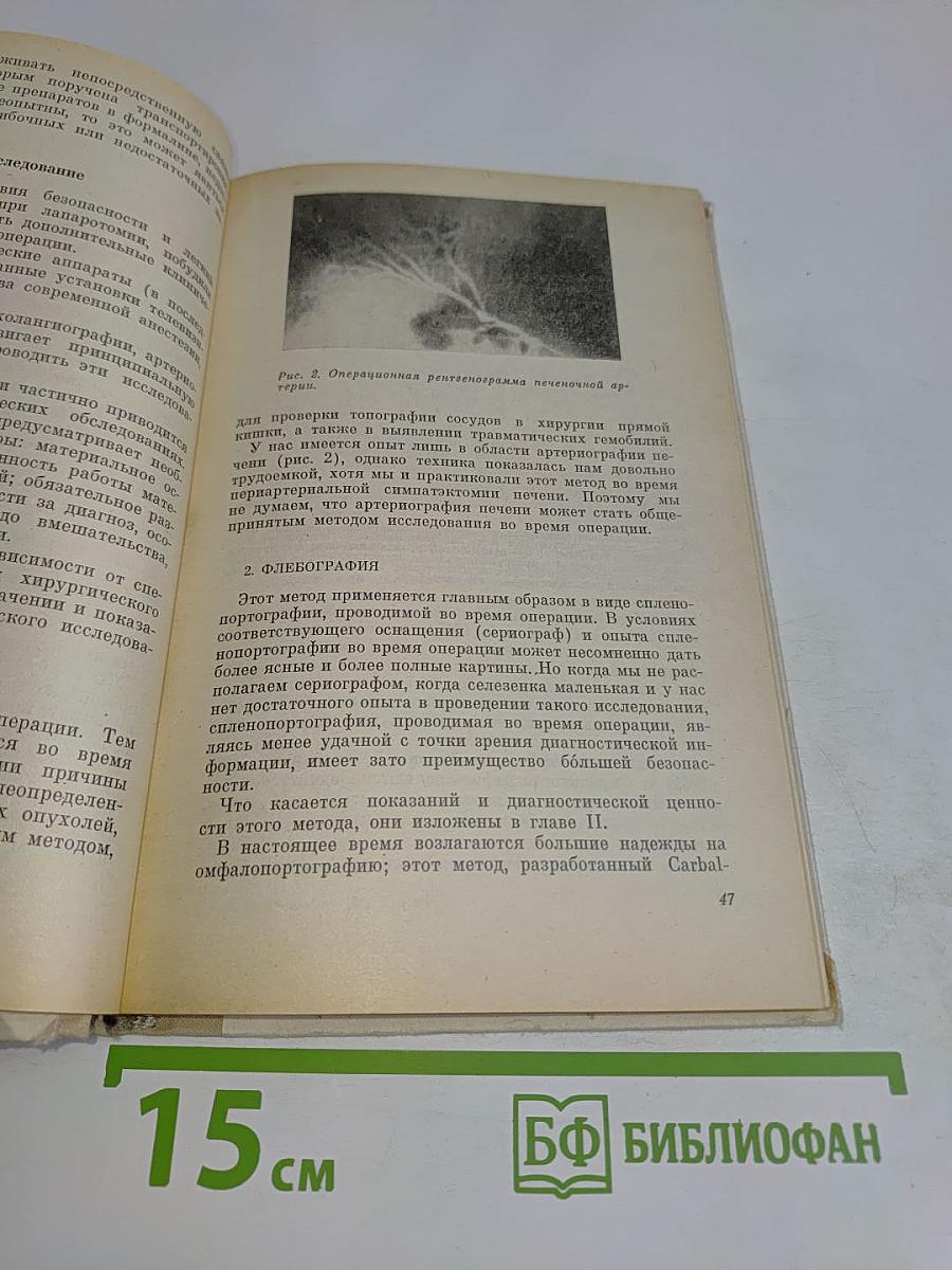 Хирургическое обследование брюшной полости