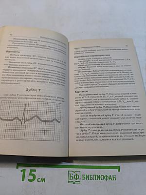 Справочник по электрокардиографии