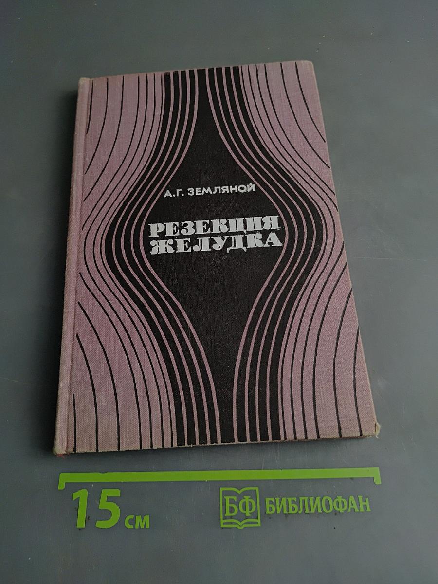 Резекция желудка