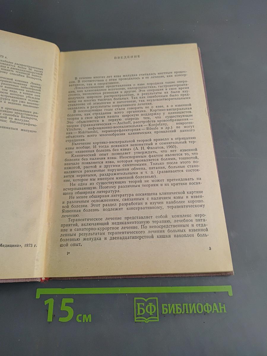 Резекция желудка